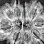 9 MK Gaurishankar 33.8mm 7.16gm - Xray