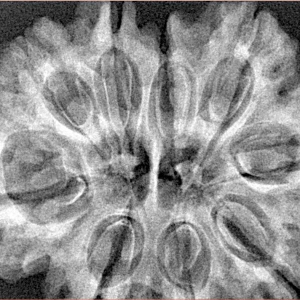 9 MK Gaurishankar 33.8mm 7.16gm - Xray