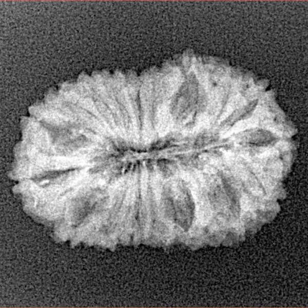18 Mukhi Rudraksha 24mm 2.26gm - Xray