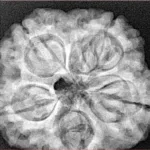 5 Mukhi Rudraksha 29mm 8.09gm - Xray