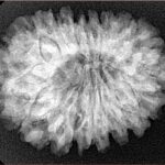 18 Mukhi Rudraksha 28.6mm 5.39gm - Xray