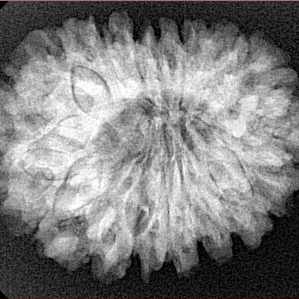 18 Mukhi Rudraksha 28.6mm 5.39gm - Xray
