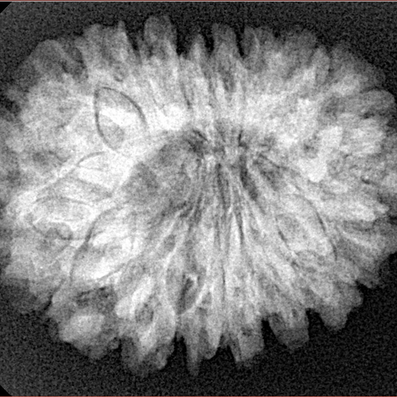 18 Mukhi Rudraksha 28.6mm 5.39gm - Xray