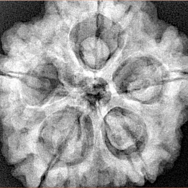 5 Mukhi Rudraksha 30mm 8.08gm - Xray