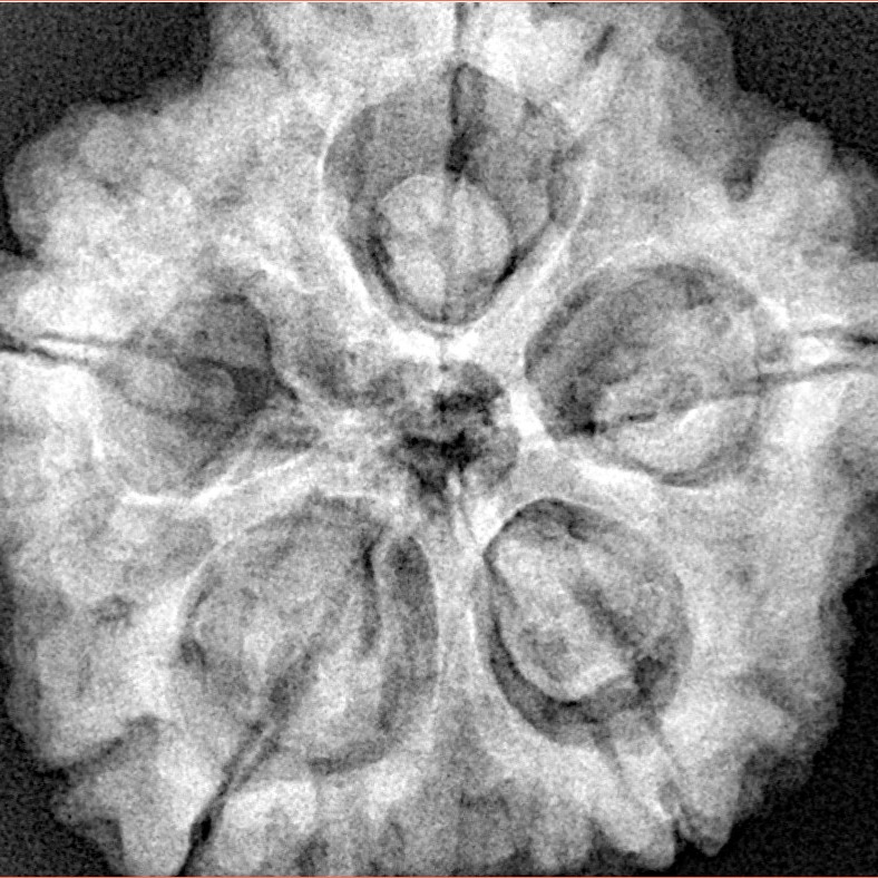 5 Mukhi Rudraksha 30mm 8.08gm - Xray