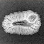 18 Mukhi Rudraksha 22.9mm 2gm - Xray