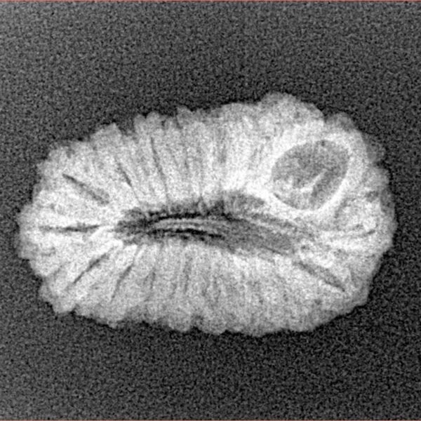 18 Mukhi Rudraksha 22.9mm 2gm - Xray
