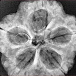 5 Mukhi Rudraksha 30mm 7.36gm - Xray
