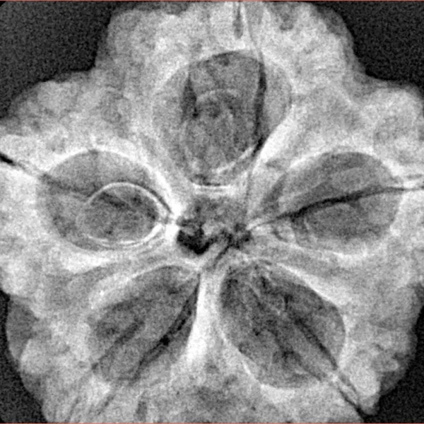 5 Mukhi Rudraksha 30mm 7.36gm - Xray