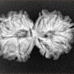 11 MK Gaurishankar 28.3mm 3.77gm - Xray