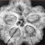 5 Mukhi Rudraksha 29.5mm 9.34gm - Xray