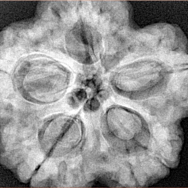 5 Mukhi Rudraksha 29.5mm 9.34gm - Xray