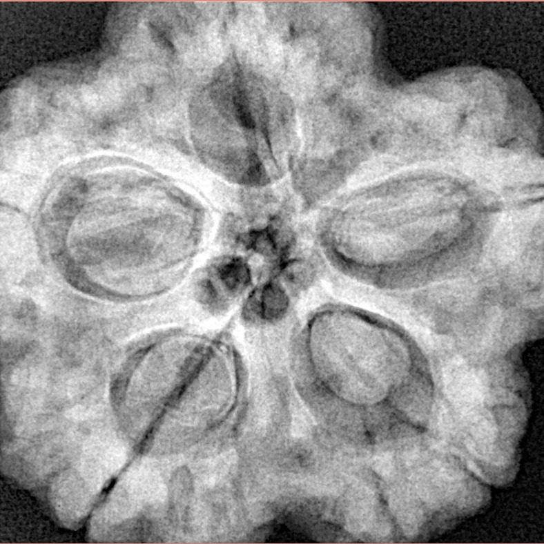 5 Mukhi Rudraksha 29.5mm 9.34gm - Xray