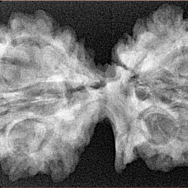 11 Mukhi G.S & Ganesh 39.5mm 6.32gm - Xray