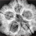 5 Mukhi Rudraksha 29.1mm 10gm - Xray