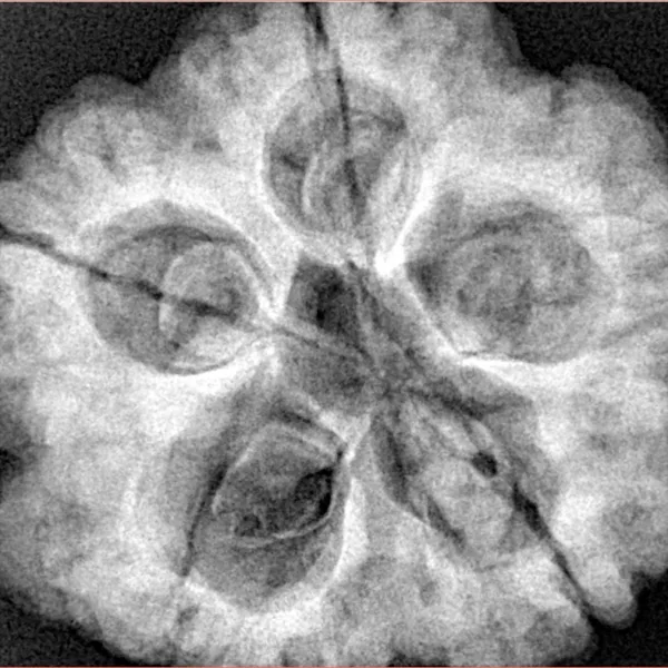 5 Mukhi Rudraksha 29.1mm 10gm - Xray