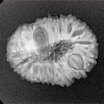 18 Mukhi Rudraksha 22.9mm 2.61gm - Xray
