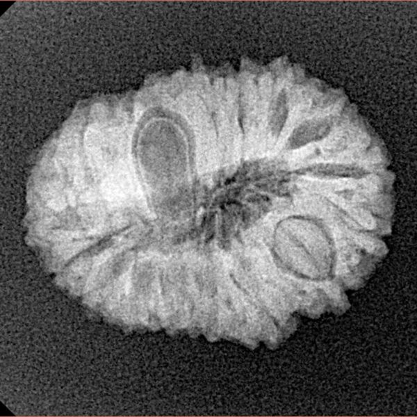 18 Mukhi Rudraksha 22.9mm 2.61gm - Xray