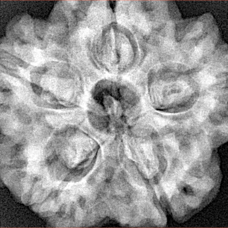 5 Mukhi Rudraksha 29.5mm 8.36gm - Xray