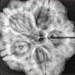 5 Mukhi Rudraksha 29.5mm 7.56gm - Xray