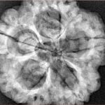 5 Mukhi Rudraksha 29.6mm 8.11gm - Xray