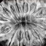 13 Mukhi Rudraksha 36.1mm 9.13gm - Xray