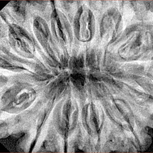 13 Mukhi Rudraksha 36.1mm 9.13gm - Xray