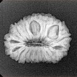 18 Mukhi Rudraksha 22.4mm 2.61gm - Xray