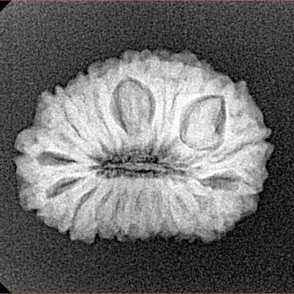 18 Mukhi Rudraksha 22.4mm 2.61gm - Xray