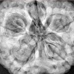 5 Mukhi Rudraksha 30.2mm 9.56gm - Xray
