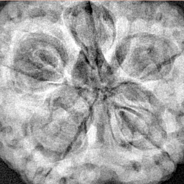5 Mukhi Rudraksha 30.2mm 9.56gm - Xray