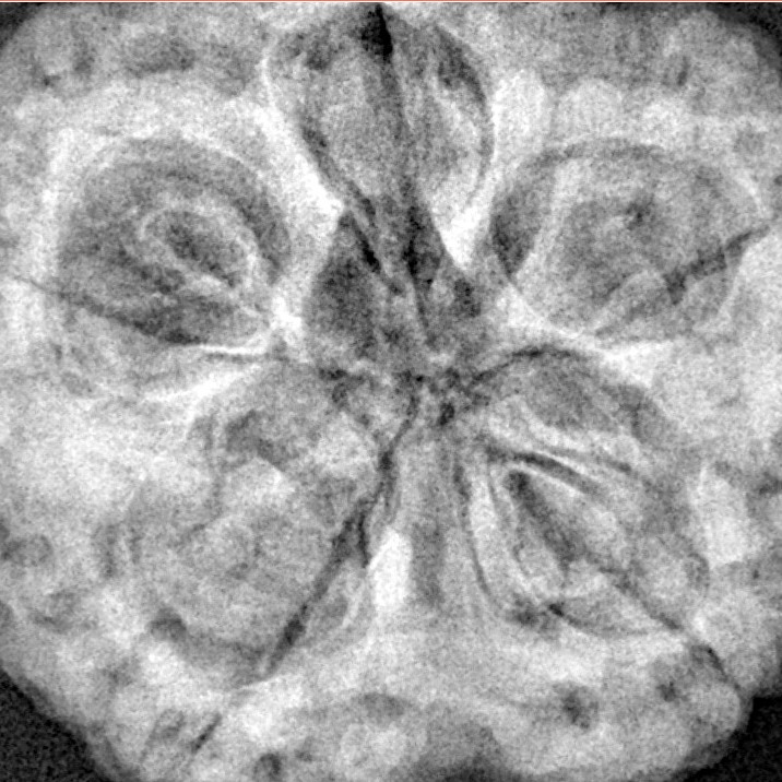 5 Mukhi Rudraksha 30.2mm 9.56gm - Xray