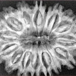 15 Mukhi Rudraksha 33.6mm 6.19gm - Xray