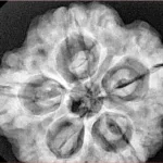 5 Mukhi Rudraksha 29.4mm 9.2gm - Xray