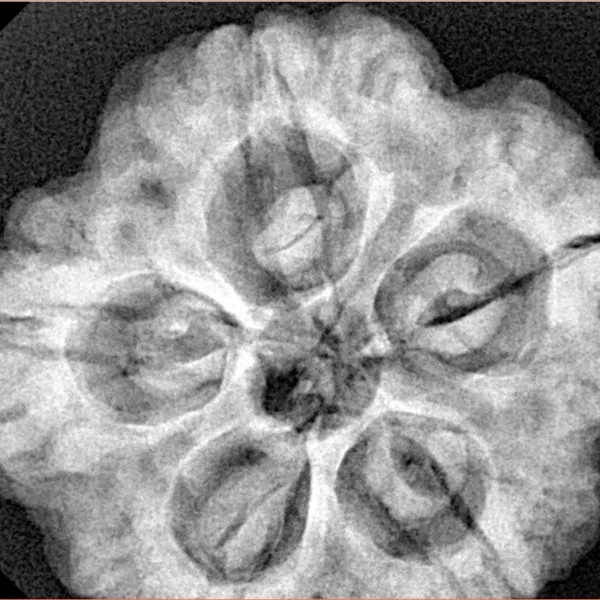 5 Mukhi Rudraksha 29.4mm 9.2gm - Xray