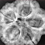 5 Mukhi Rudraksha 30.8mm 8.38gm - Xray