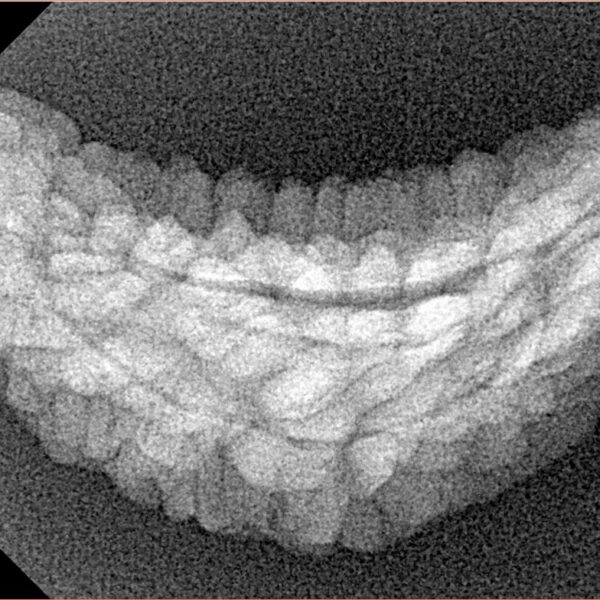 1 Mukhi Rudraksha 31.4mm 2.64gm - Xray