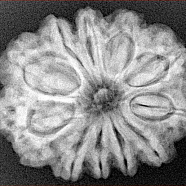 11 Mukhi Rudraksha 28.2mm 5.84gm - Xray