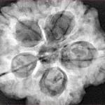 5 Mukhi Rudraksha 30mm 9.12gm - Xray