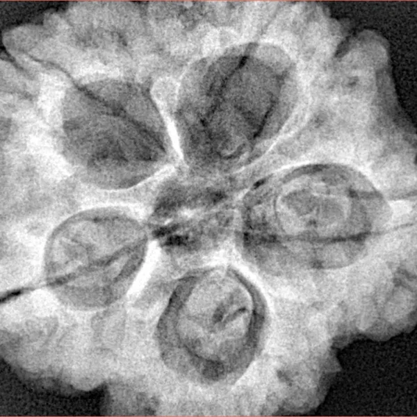 5 Mukhi Rudraksha 30mm 9.12gm - Xray