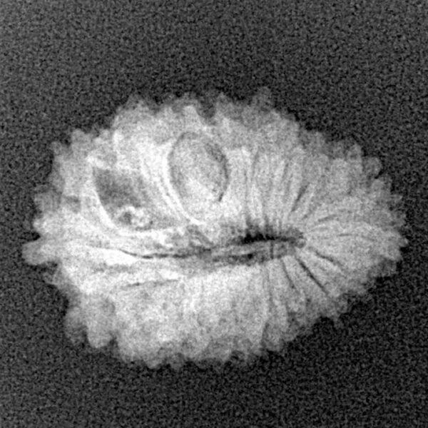 20 Mukhi Rudraksha 20.9mm 1.99gm - Xray