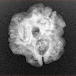 3 Mukhi Rudraksha 22.1mm 3.32gm - Xray