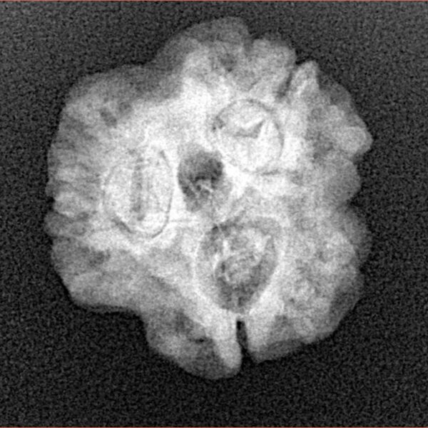 3 Mukhi Rudraksha 22.1mm 3.32gm - Xray