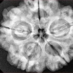 5 Mukhi Rudraksha 30.3mm 8.06gm - Xray
