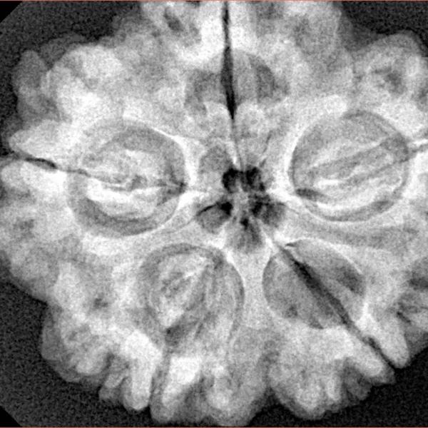 5 Mukhi Rudraksha 30.3mm 8.06gm - Xray