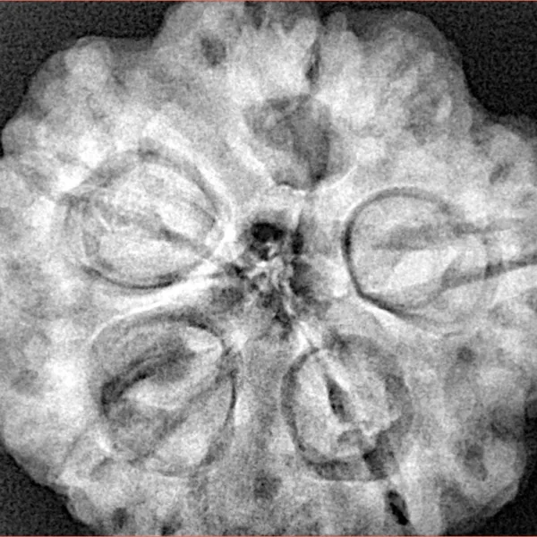 5 Mukhi Rudraksha 29.5mm 9.33gm - Xray