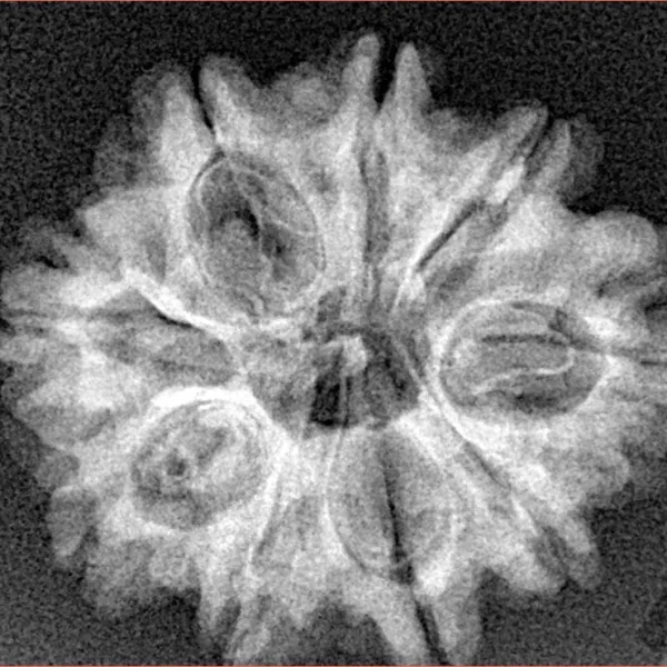 9 Mukhi Rudraksha 25.3mm 4gm - Xray