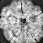5 Mukhi Rudraksha 29mm 8.27gm - Xray