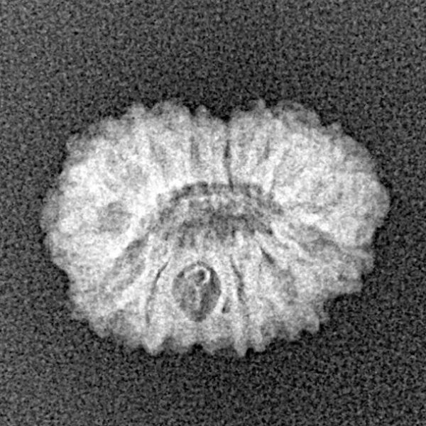 14 Mukhi Rudraksha 16mm 1.07gm - Xray