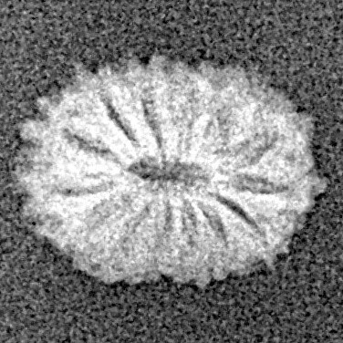 14 Mukhi Rudraksha 11.2mm 0.35gm - Xray